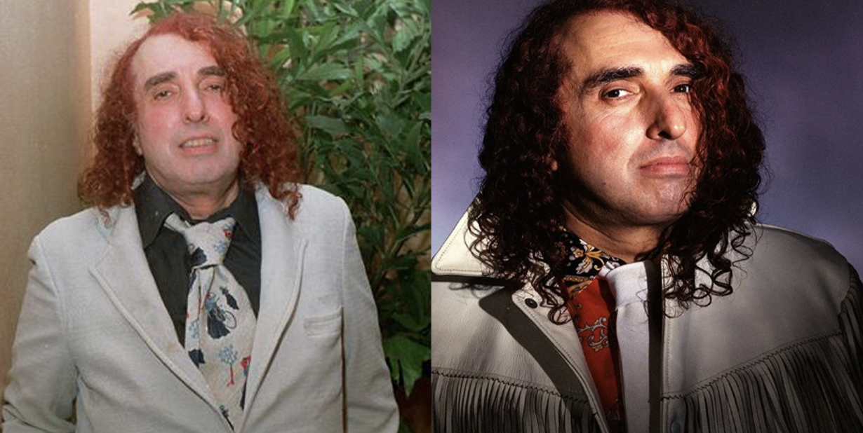 Tim Tim Singer Sensitive Facts About Tiny Tim, The High-Pitched Tulip Song Singer
